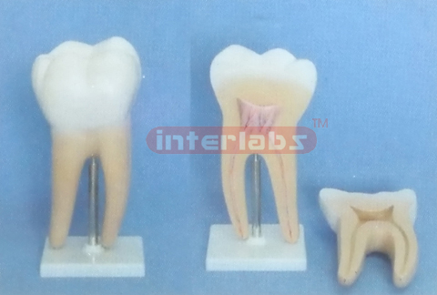 GIANT MOLAR, 2 PCS/SET